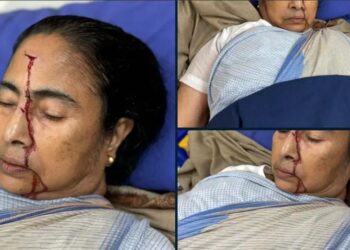 Breaking News: ಪಶ್ಚಿಮ ಬಂಗಾಳ ಸಿಎಂ ಮಮತಾ ಬ್ಯಾನರ್ಜಿ ತಲೆಗೆ ಪೆಟ್ಟು! ; ಆಸ್ಪತ್ರೆಗೆ ದಾಖಲು